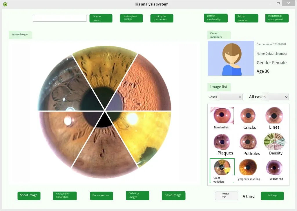 Digital Iridology Camera Iridology Analyzer Iris Analyzer Device Iris Diagnosis With Analysis Reports Customer Management System