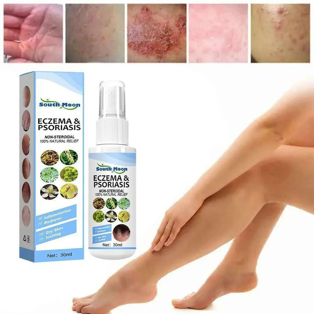 Herbal Psoriasis Relief Spray